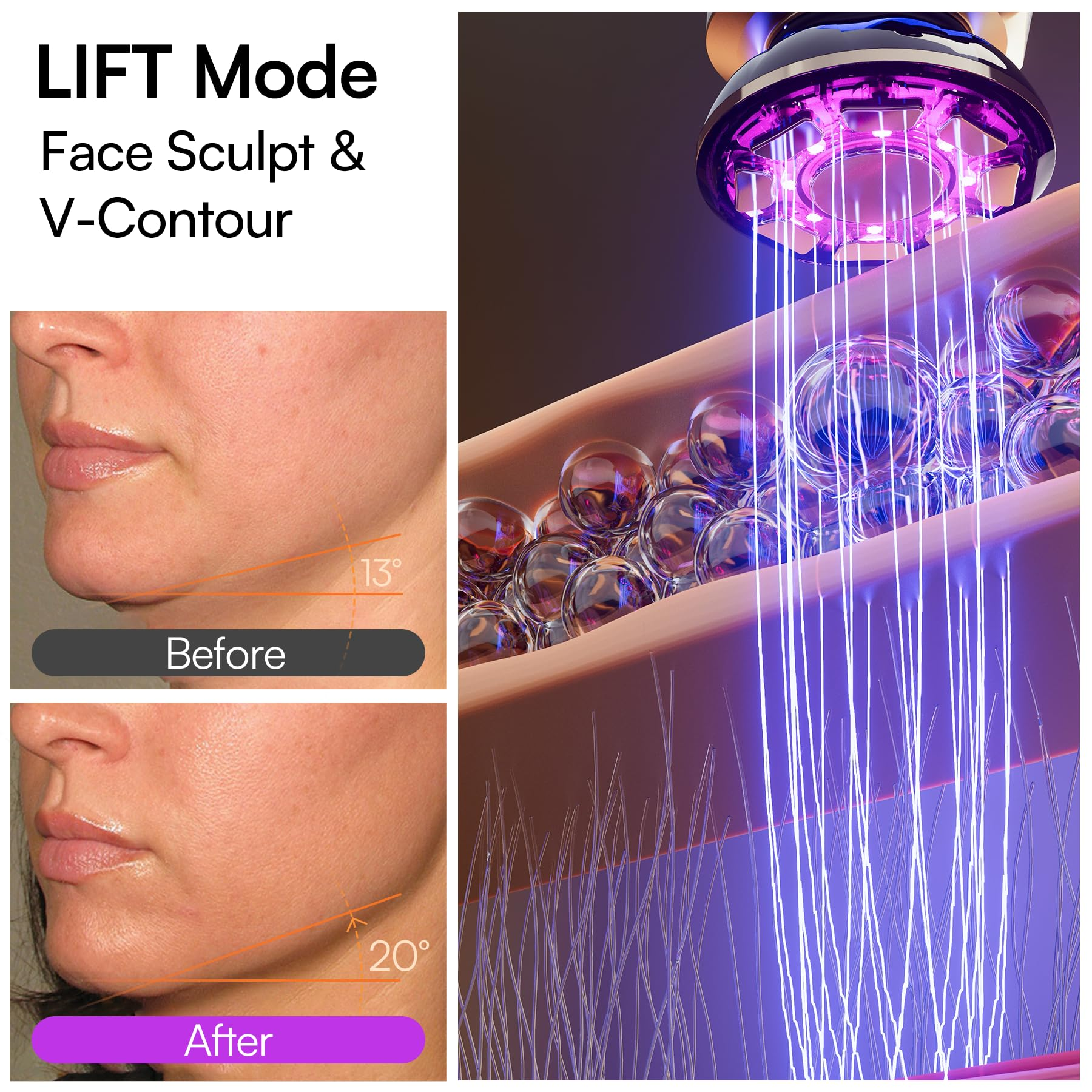 Tired of Sagging Skin? This Microcurrent Facial Device Lifts & Tones Your Face At Home - No Spa Needed